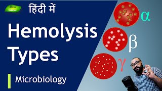 समझें Hemolysis कितनी तरह की होती है   Basic Science Series Hindi [upl. by Ibor]