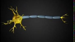 Myelin sheath is destroyed Multiple Sclerosis [upl. by Uel]