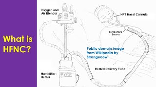 What is HFNC [upl. by Renita]