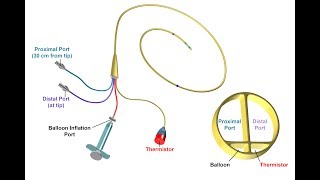 Proper Insertion and Use of a Pulmonary Artery Catheter  BAVLS [upl. by Savage]