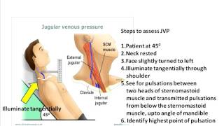 Jugular venous pulse clinical aspects [upl. by Ahseer]