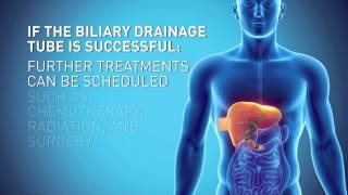 Biliary Drain [upl. by Body833]