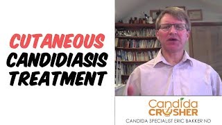 Cutaneous Candidiasis Treatment [upl. by Paddy211]