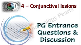 Conjunctival Lesions PG Entrance Questions amp Discussion 4 [upl. by Nnoryt607]