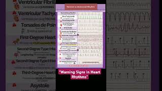 Normal vs Abnormal Heart Rhythms Quick ECG Guidequot musicart trendingshortsviralshortviralvideo [upl. by Rodoeht]