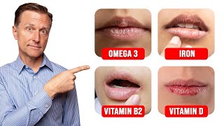 5 Things Your LIPS Can Tell You about Your Nutritional State [upl. by Daegal]