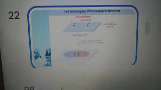 Lelectrosynérèseimmunoélèctrodiffusiontechnique de précipitation🌷Immunologie 3ème année med💊 [upl. by Mailliwnhoj]