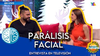 ¿Cómo saber si tengo una Parálisis Facial Entrevista en TV paralisisfacial fisioterapia tvazteca [upl. by Baumbaugh665]