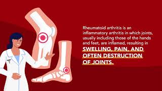 Joint Disorders Rheumatoid Arthritis RA  Merck Manual Consumer Version [upl. by Mehalick]