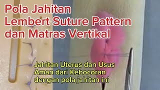 Pola Jahitan Lembert Suture Pattern dan Matras Vertikal pada operasi Caesar dan operasi usus [upl. by Fionna]