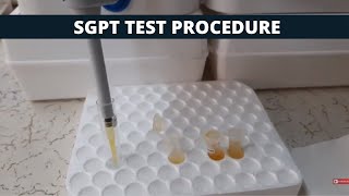 SGPT Test Procedure  SGPT Simple Test Procedure [upl. by Enyledam]