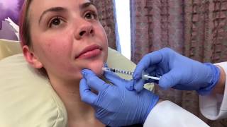 Botox for Chin Dimpling Preventing Wrinkles with Dr Michelle Ellern [upl. by Barta]