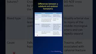 Subdural vs epidural hematoma features neuroradiology radiology computedtomography [upl. by Rushing]