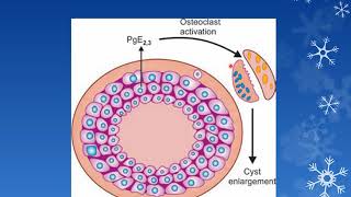 ODONTOGENIC CYSTS PART 1 Oral Pathology  3rd BDS [upl. by Josiah]