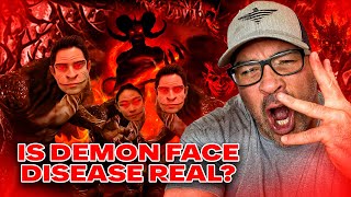 REAL Demon Face Syndrome RevealedShapeshifters Among Us You Will Not Believe This [upl. by Ogram854]