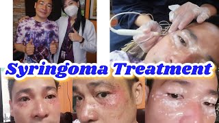 Syringoma Treatment  Home Service [upl. by Adirahs]