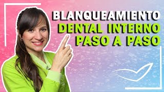 Blanqueamiento Dental Interno Paso a Paso l Protocolo y Cuánto Dura [upl. by Vivyan]