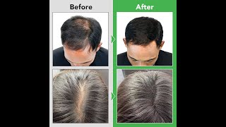 Dok Bua Ku Original Reduce Hair Loss Herbal Shampoo 300ml hairfallsolution dandruff itching [upl. by Adnilreb]