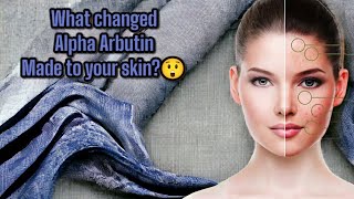 What Is Alpha Arbutin  Its Benefits And Uses For Skin [upl. by Ahtel365]