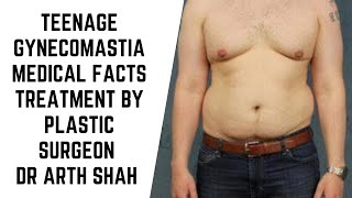 Teenage Gynecomastia Medical facts and Treatment options explained by Plastic Surgeon Dr Arth Shah [upl. by Lyrej]