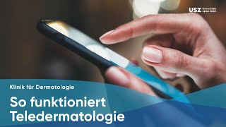 So funktioniert Teledermatologie [upl. by Hanan]