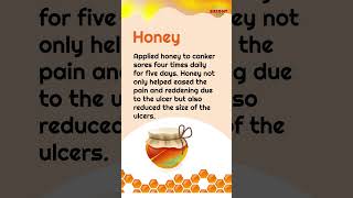 Natural Remedies To Cure Mouth Ulcers [upl. by Essilem591]