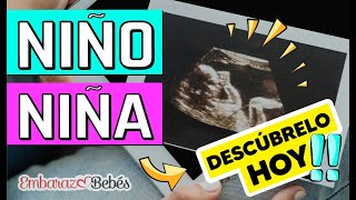 Cómo saber si es NIÑO o NIÑA por Ultrasonido  SEMANA 12 a 20 ¡Detecta las diferencias [upl. by Waller364]