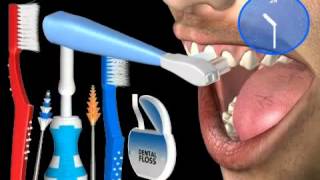 What is Teeth Bleaching [upl. by Willcox]