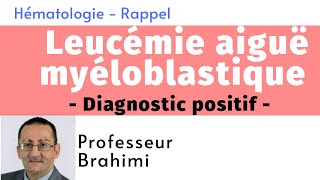 Leucémie Aiguë Myéloblastique Diagnostic positif [upl. by Kern147]