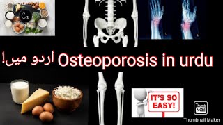 Osteoporosis in urdu hindi osteoporosis bone calcium vitamind hormones menopause [upl. by Walke30]