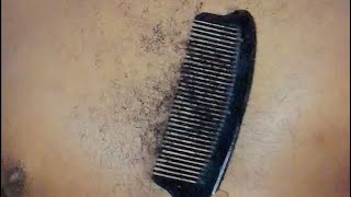 Asmr chest massage scratching amp combing out dirt from your chest 💆‍♂️ [upl. by Sorcha]