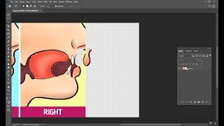 Etiology of Malocclusion Lecture 2 Part 2 [upl. by Guise]