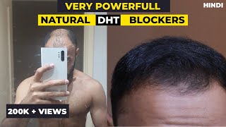 Very Powerful Natural DHT Blockers that will Stop Hair Loss in 2022 [upl. by Saied394]