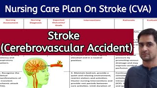 Nursing care plan on strokeNursing care plan on CVANursing care plan on cerebrovascular accident [upl. by Airyt846]