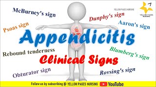 Clinical signs of Appendicitis  NCLEX REVIEW [upl. by Elorac747]