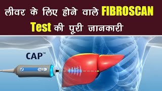 fibroscan liver  fibroscan  test price score results  in hindi  fibroscan test kaise hota hai [upl. by Bertasi]