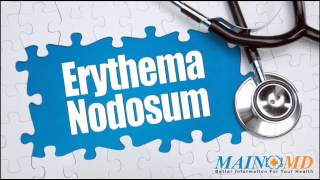 Erythema Nodosum ¦ Treatment and Symptoms [upl. by Barkley]