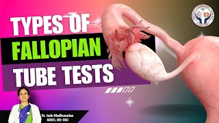 Fallopian Tubes Understanding the Essential Tube Tests [upl. by Dnob]