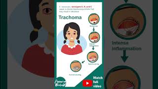 Chlamidiae and its serotypes  Microbio in 1 minute [upl. by Esilahs745]