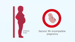 How Rh factor affects a pregnancy [upl. by Ynavoj47]