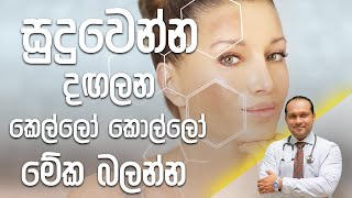 සුදුවෙන්න දඟලන කෙල්ලෝ කොල්ලෝ මේක බලන්න  Dr Namal Wijesinghe [upl. by Nayve53]