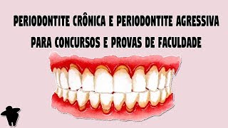 Classificação das Doenças Periodontais  Periodontite Crônica e Periodontite Agressiva DE 7 [upl. by Dolloff]