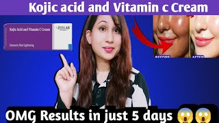 Kojic acid and vitamin c cream honest Review Kojic acid vitamin C creamगोरा करने वाली क्रीम। [upl. by Ma]