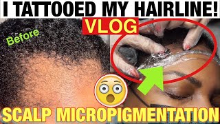 I BOUGHT A NEW HAIRLINE I TATTOOED MY EDGES 😲 MUST SEE SMP VLOG ALOPECIA HAIR LOSS PCOS STRUGGLE [upl. by Ellehcrad515]