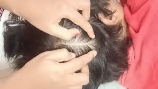 ASMR  Scalp Searching Relaxation and Sleep 💤😴💤💤 135 [upl. by Lleruj]