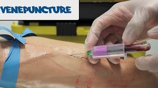 Venipuncture  How to take Blood  OSCE Guide old version  UKMLA  CPSA [upl. by Hiamerej]