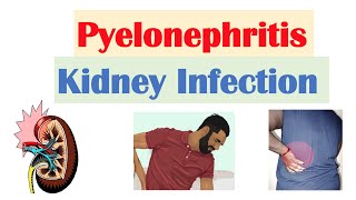 Pyelonephritis Kidney Infection  Causes Pathophysiology Signs amp Symptoms Diagnosis Treatment [upl. by Marielle375]