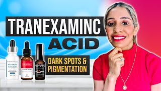 TRANEXAMIC ACID FOR DARK SPOTS MELASMA HYPER PIGMENTATION Topical Creams [upl. by Varin]