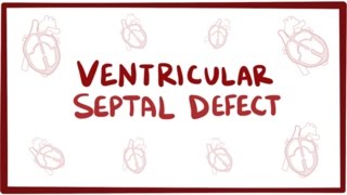 Ventricular septal defect VSD  repair causes symptoms amp pathology [upl. by Haleelahk]