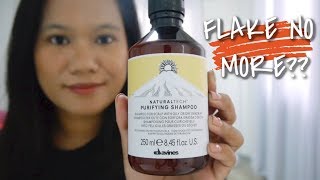 IS IT EFFECTIVE  DAVINES PURIFYING SHAMPOO  SEBORRHEIC DERMATITIS [upl. by Alyhc296]